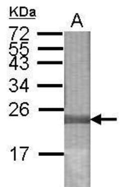 Invitrogen LONP2 Polyclonal Antibody 100 &mu;L; Unconjugated:Antibodies,