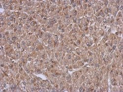 Invitrogen Arfaptin 1 Polyclonal Antibody 100 μL; Unconjugated:Antibodies,