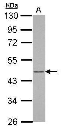 Invitrogen Arfaptin 1 Polyclonal Antibody 100 μL; Unconjugated:Antibodies,
