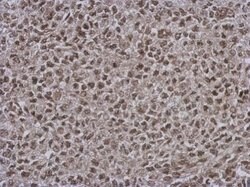 Invitrogen DNAJB7 Polyclonal Antibody 100 &mu;L; Unconjugated:Antibodies,