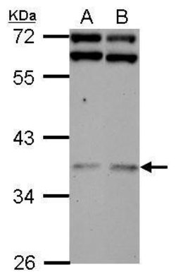 Invitrogen DNAJB7 Polyclonal Antibody 100 &mu;L; Unconjugated:Antibodies,