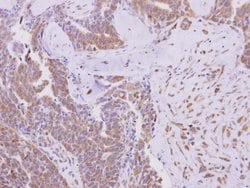 Invitrogen KBTBD3 Polyclonal Antibody 100 &mu;L; Unconjugated:Antibodies,