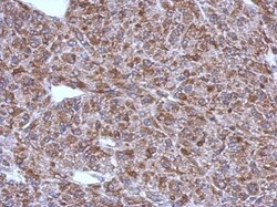 Invitrogen ACSM1 Polyclonal Antibody 100 &mu;L; Unconjugated:Antibodies,