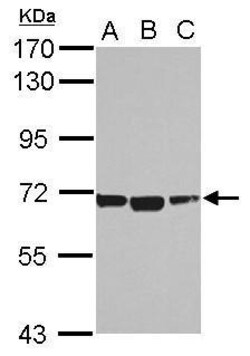 Invitrogen ACSM1 Polyclonal Antibody 100 &mu;L; Unconjugated:Antibodies,