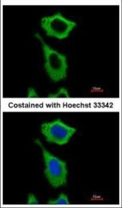 Invitrogen ALDH1A1 Polyclonal Antibody 100 &mu;L | Buy Online | Invitrogen&trade; | Fisher Scientific