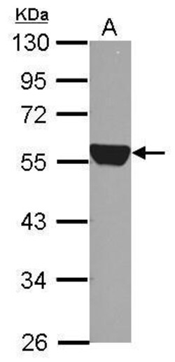 Invitrogen ALDH1A1 Polyclonal Antibody 100 &mu;L | Buy Online | Invitrogen&trade; | Fisher Scientific