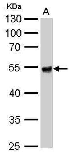 Invitrogen ALDH1A1 Polyclonal Antibody 100 &mu;L | Buy Online | Invitrogen&trade; | Fisher Scientific