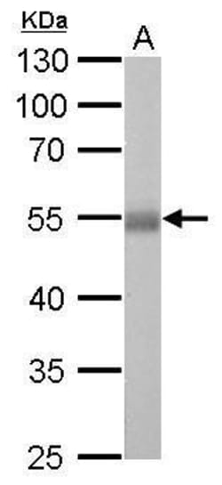Invitrogen ALDH1A1 Polyclonal Antibody 100 &mu;L | Buy Online | Invitrogen&trade; | Fisher Scientific