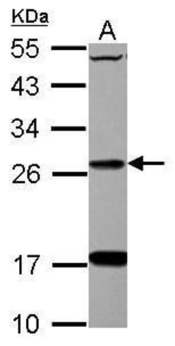 Invitrogen DHRS2 Polyclonal Antibody 100 &mu;L; Unconjugated:Antibodies,