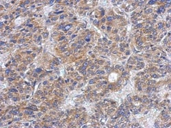 Invitrogen CK1 delta Polyclonal Antibody 100 &mu;L; Unconjugated:Antibodies,
