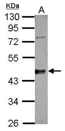 Invitrogen CK1 delta Polyclonal Antibody 100 &mu;L; Unconjugated:Antibodies,