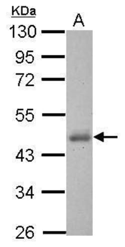 Invitrogen CK1 delta Polyclonal Antibody 100 &mu;L; Unconjugated:Antibodies,