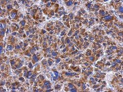 Invitrogen SPATA4 Polyclonal Antibody 100 &mu;L; Unconjugated:Antibodies,
