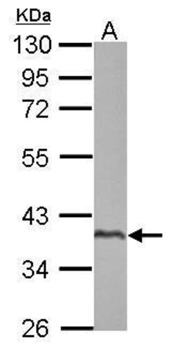 Invitrogen SPATA4 Polyclonal Antibody 100 &mu;L; Unconjugated:Antibodies,