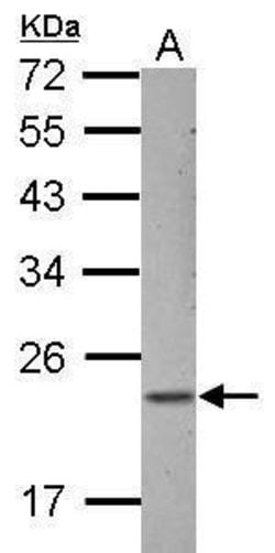 Invitrogen ZNF22 Polyclonal Antibody 100 &mu;L; Unconjugated:Antibodies,