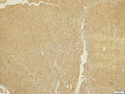ADAMTS5 Polyclonal Antibody:Antibodies, Polyclonal