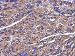 ADAMTS5 Polyclonal Antibody:Antibodies, Polyclonal