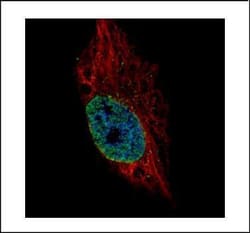 Invitrogen ESRP2 Polyclonal Antibody 100 &mu;L | Buy Online | Invitrogen&trade; | Fisher Scientific