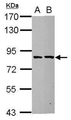 ESRP2 Polyclonal Antibody:Antibodies, Polyclonal