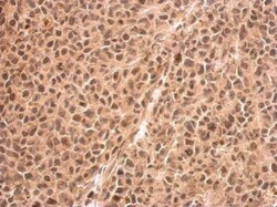 Invitrogen RED Polyclonal Antibody 100 &mu;L; Unconjugated:Antibodies,