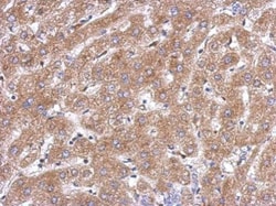 Invitrogen ACOT12 Polyclonal Antibody 100 &mu;L; Unconjugated:Antibodies,