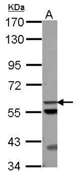 Invitrogen ACOT12 Polyclonal Antibody 100 &mu;L; Unconjugated:Antibodies,
