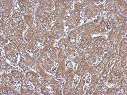 Invitrogen ALDH1A1 Polyclonal Antibody 100 μL; Unconjugated:Antibodies,