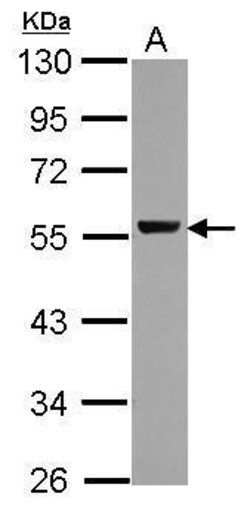 Invitrogen ALDH1A1 Polyclonal Antibody 100 μL; Unconjugated:Antibodies,