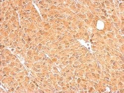 Invitrogen GALM Polyclonal Antibody 100 &mu;L; Unconjugated:Antibodies,