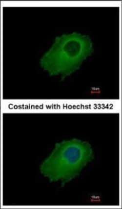 Invitrogen SERPINE2 Polyclonal Antibody 100 &mu;L; Unconjugated:Antibodies,
