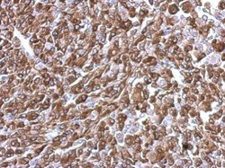 Invitrogen KIFC2 Polyclonal Antibody 100 &mu;L; Unconjugated:Antibodies,