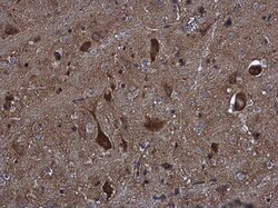 Invitrogen KIFC2 Polyclonal Antibody 100 &mu;L; Unconjugated:Antibodies,