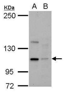 Invitrogen KIFC2 Polyclonal Antibody 100 &mu;L; Unconjugated:Antibodies,