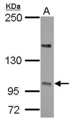 Invitrogen PPP4R4 Polyclonal Antibody 100 &mu;L; Unconjugated:Antibodies,