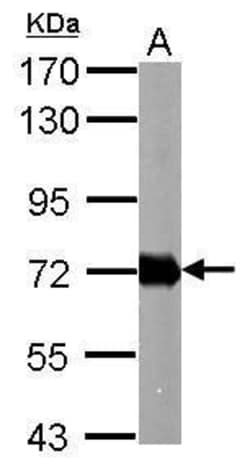 Invitrogen Helicobacter pylori Urease B Polyclonal Antibody 100 μL;