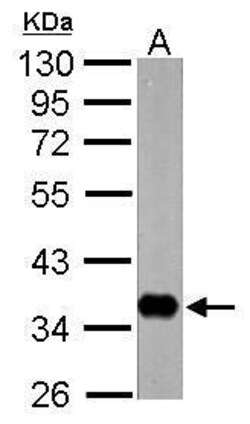 Invitrogen nrv1 Polyclonal Antibody 100 μL; Unconjugated:Antibodies,