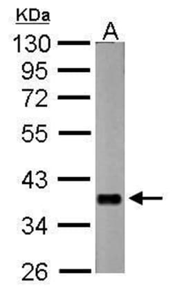 Invitrogen nrv2 Polyclonal Antibody 100 &mu;L; Unconjugated:Antibodies,
