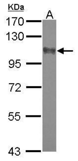 Invitrogen™ SAPAP2 Polyclonal Antibody