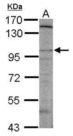 Invitrogen™ SAPAP2 Polyclonal Antibody