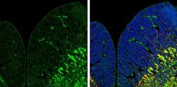 Invitrogen ZPK Polyclonal Antibody 100 &mu;L | Buy Online | Invitrogen&trade; | Fisher Scientific