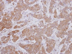 Invitrogen&trade;&nbsp;ZPK Polyclonal Antibody