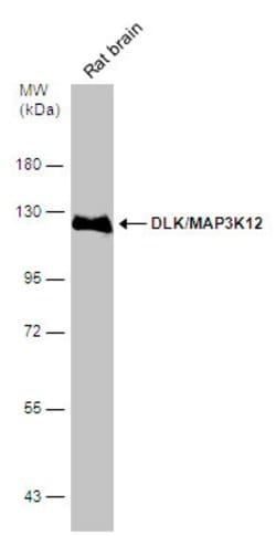 Invitrogen ZPK Polyclonal Antibody 100 &mu;L | Buy Online | Invitrogen&trade; | Fisher Scientific