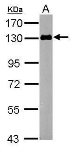 Invitrogen ZPK Polyclonal Antibody 100 &mu;L | Buy Online | Invitrogen&trade; | Fisher Scientific