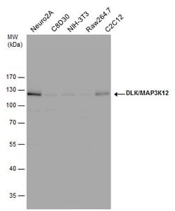 Invitrogen ZPK Polyclonal Antibody 100 &mu;L | Buy Online | Invitrogen&trade; | Fisher Scientific