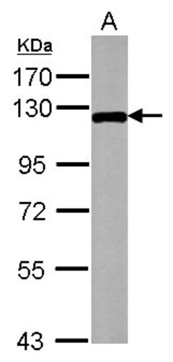 Invitrogen ZPK Polyclonal Antibody 100 &mu;L | Buy Online | Invitrogen&trade; | Fisher Scientific