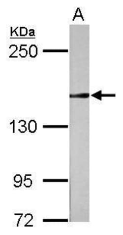 Invitrogen RAD50 Polyclonal Antibody 100 &mu;L; Unconjugated:Antibodies,
