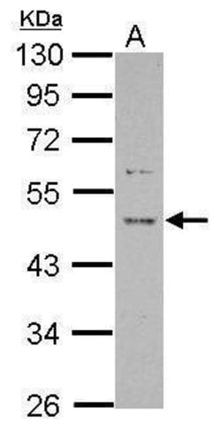 Invitrogen PRR5 Polyclonal Antibody 100 &mu;L; Unconjugated:Antibodies,