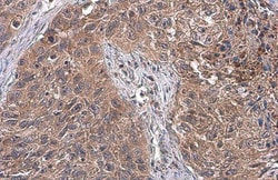 Invitrogen ATG12 Polyclonal Antibody 100 &mu;L; Unconjugated:Antibodies,