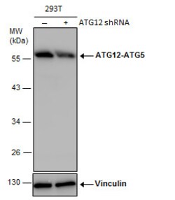 Invitrogen ATG12 Polyclonal Antibody 100 &mu;L; Unconjugated:Antibodies,