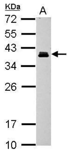 Invitrogen CRX Polyclonal Antibody 100 &mu;L | Buy Online | Invitrogen&trade; | Fisher Scientific